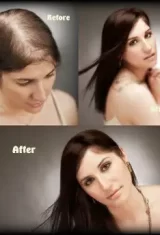 PIC IMAGE HAIR REPLACEMENT